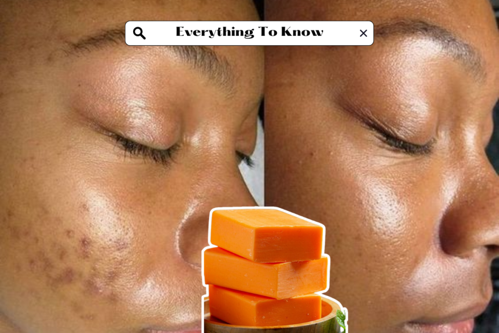 A bar of Kojic Acid Soap, known for its skin-brightening properties, resting on a white surface.