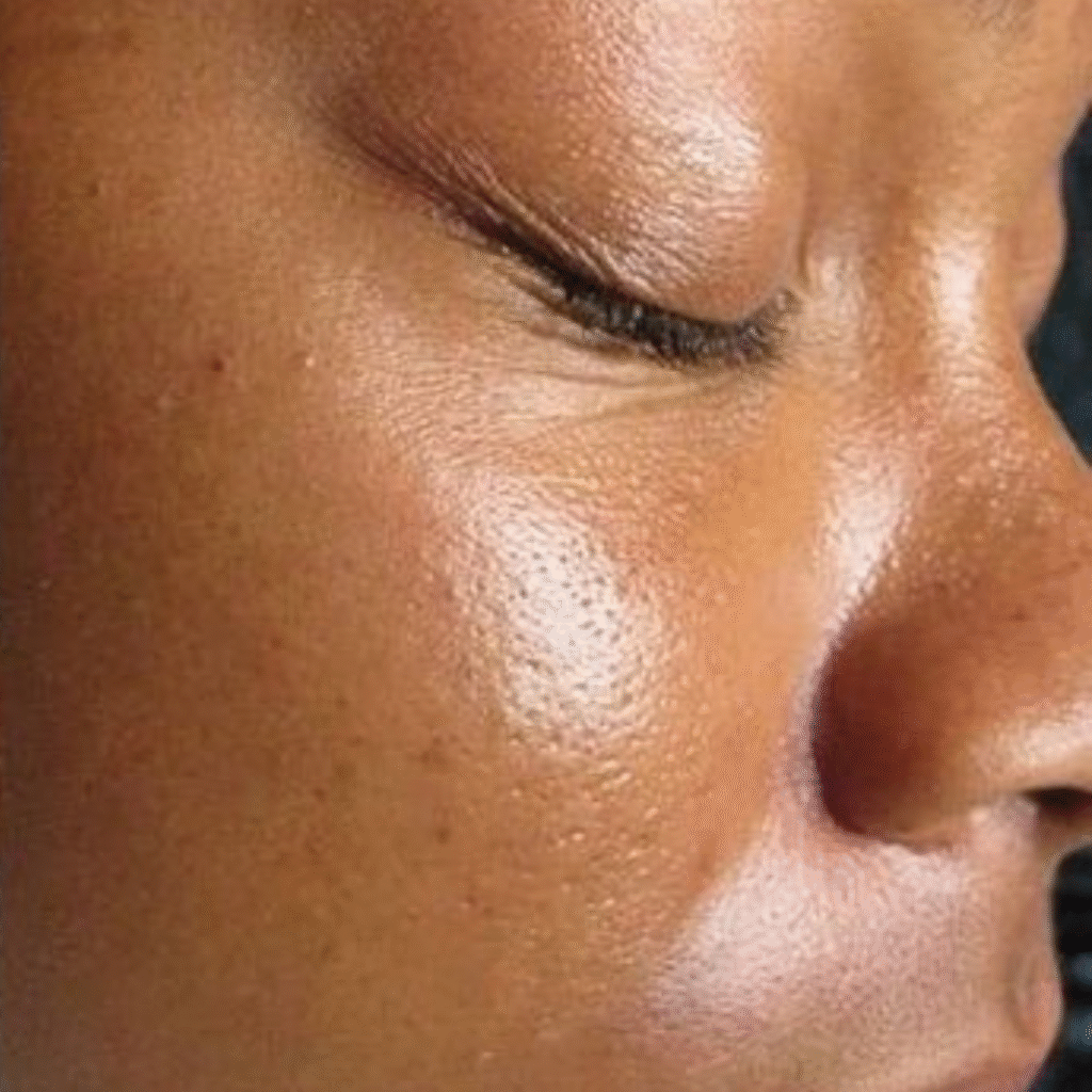 After using Kojic Acid Soap